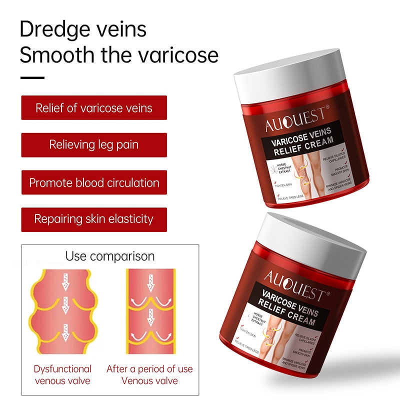 AUQUEST Varicose Veins Relief Cream Vasculitis Phlebitis Spider Pain Relief Ointment Medical Plaster Body Care 80g